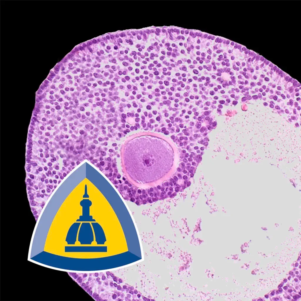 Ovarian Tumor Pathology icon