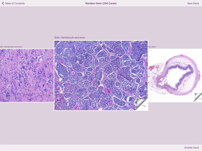 Appendiceal Pathology screenshot 5 of 6
