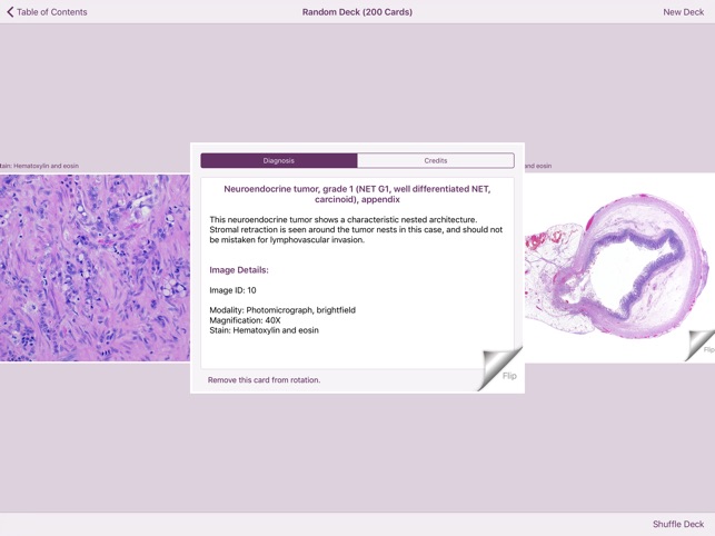 Appendiceal Pathology screenshot 6 of 6