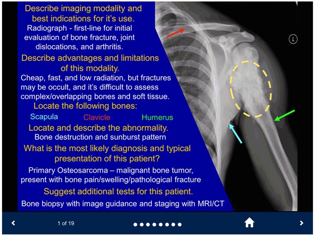 Basic Radiology - SecondLook screenshot 3 of 10