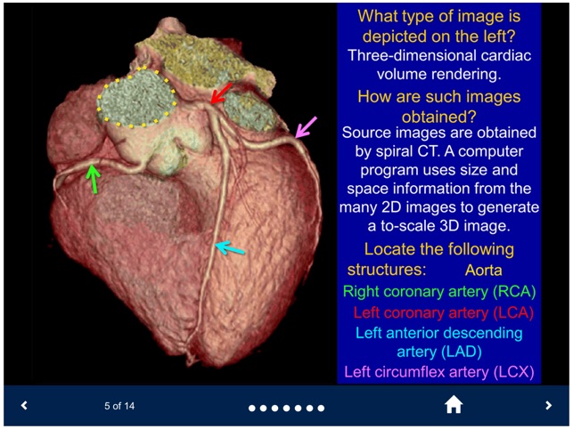 Basic Radiology - SecondLook screenshot 4 of 10