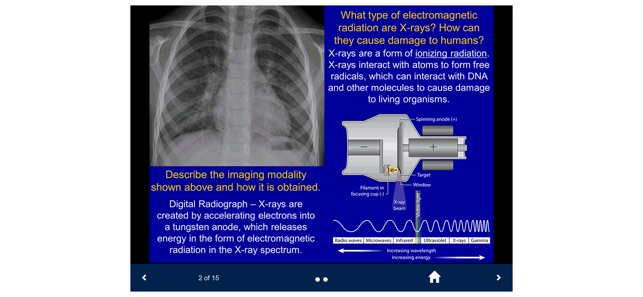Basic Radiology - SecondLook screenshot 7 of 10