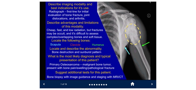 Basic Radiology - SecondLook screenshot 8 of 10