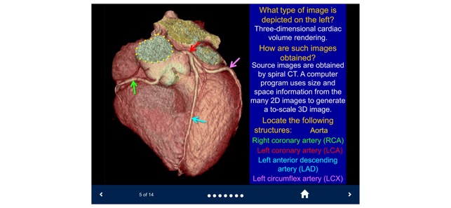 Basic Radiology - SecondLook screenshot 9 of 10