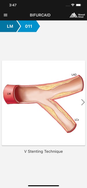 BifurcAID screenshot 6 of 6