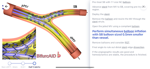 Bifurcaid 3D screenshot 4 of 12