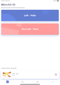 Bifurcaid 3D screenshot 5 of 12