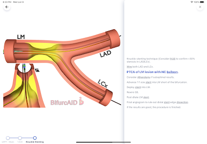 Bifurcaid 3D screenshot 8 of 12