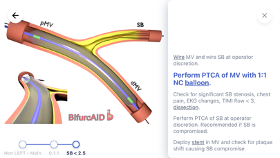 Bifurcaid 3D screenshot 4 of 20