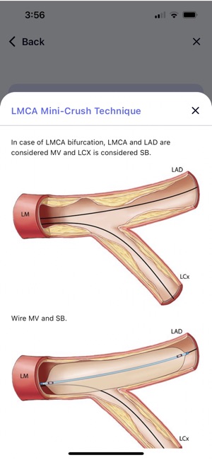 CalcificAID screenshot 12 of 14