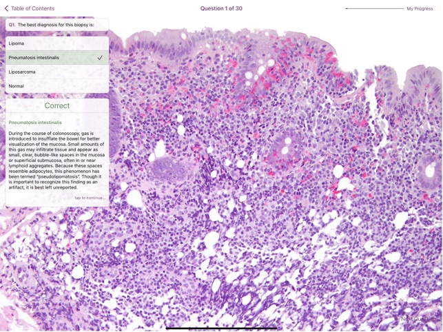 Colonic Pathology screenshot 4 of 6