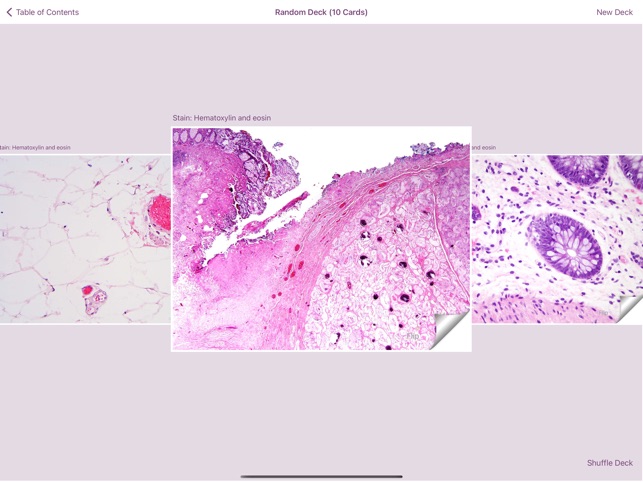 Colonic Pathology screenshot 5 of 6