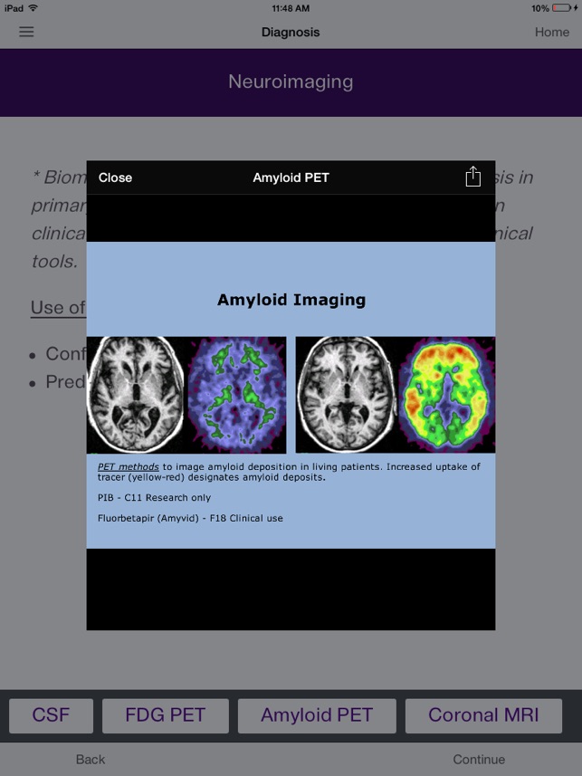 ConsultGeri: Dementia screenshot 5 of 10