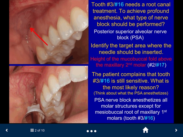 Dental Anesthesia-SecondLook screenshot 2 of 25