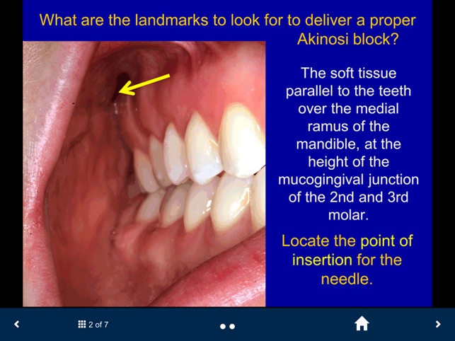 Dental Anesthesia-SecondLook screenshot 3 of 25