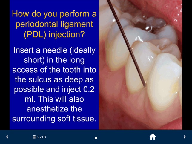 Dental Anesthesia-SecondLook screenshot 5 of 25