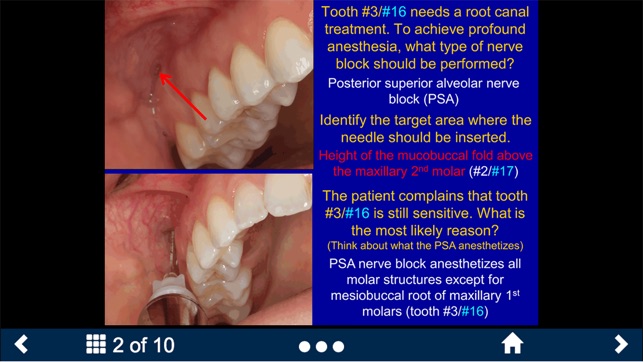 Dental Anesthesia-SecondLook screenshot 7 of 25