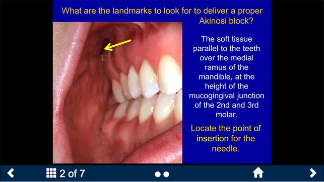 Dental Anesthesia-SecondLook screenshot 8 of 25
