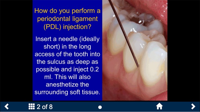 Dental Anesthesia-SecondLook screenshot 10 of 25
