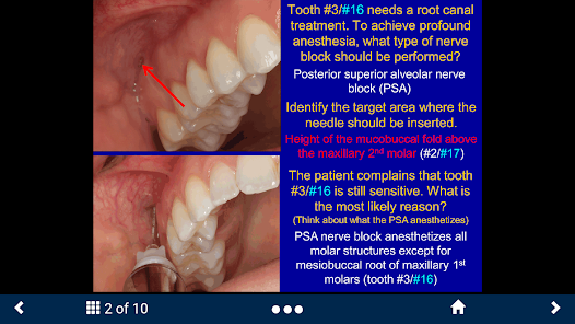 Dental Anesthesia-SecondLook screenshot 22 of 25