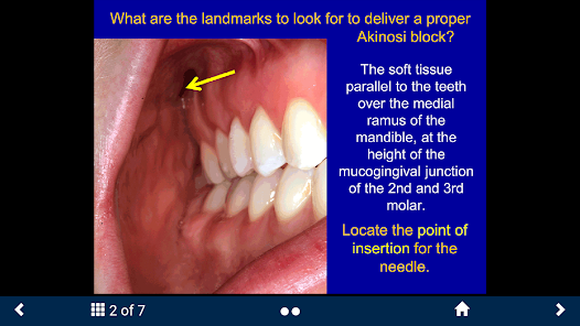 Dental Anesthesia-SecondLook screenshot 13 of 25