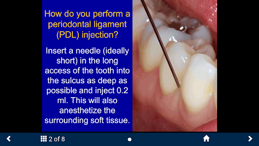 Dental Anesthesia-SecondLook screenshot 20 of 25