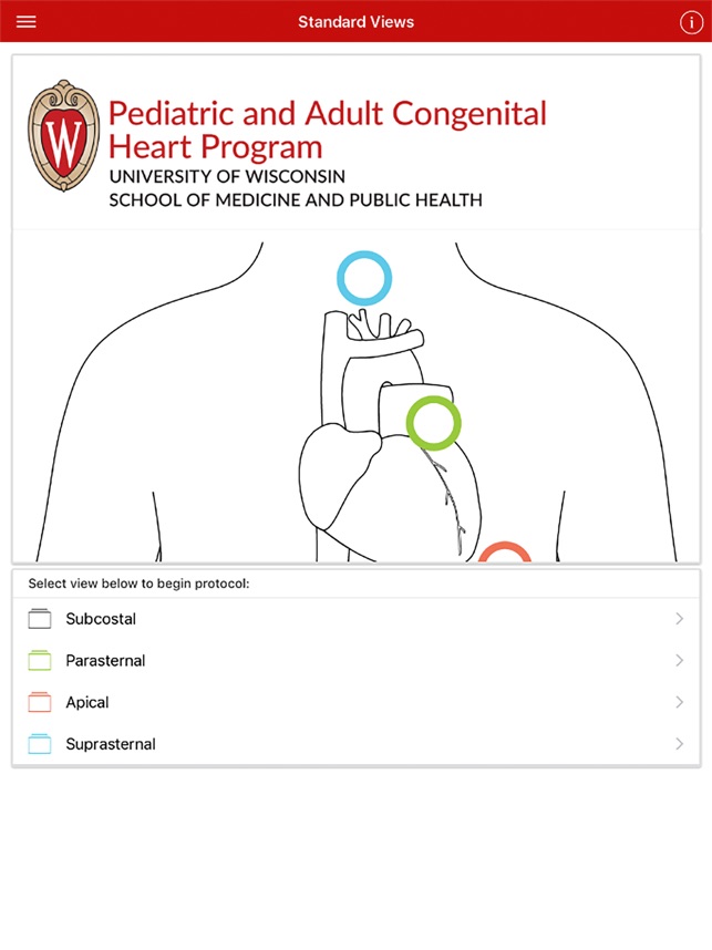 Echo UW screenshot 1 of 10
