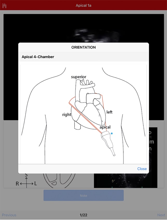 Echo UW screenshot 3 of 10