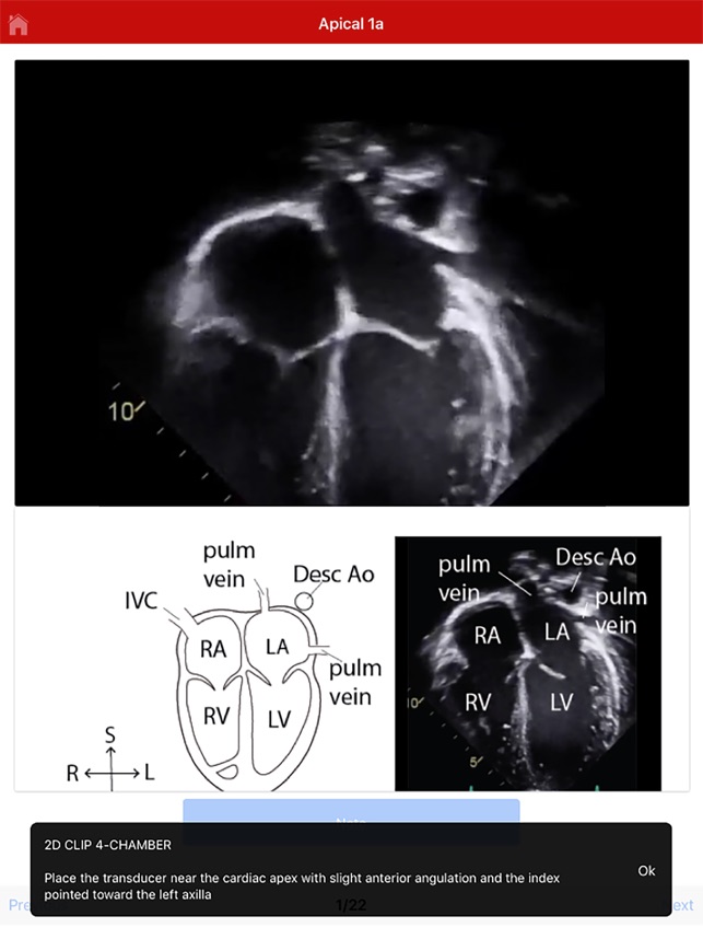 Echo UW screenshot 4 of 10