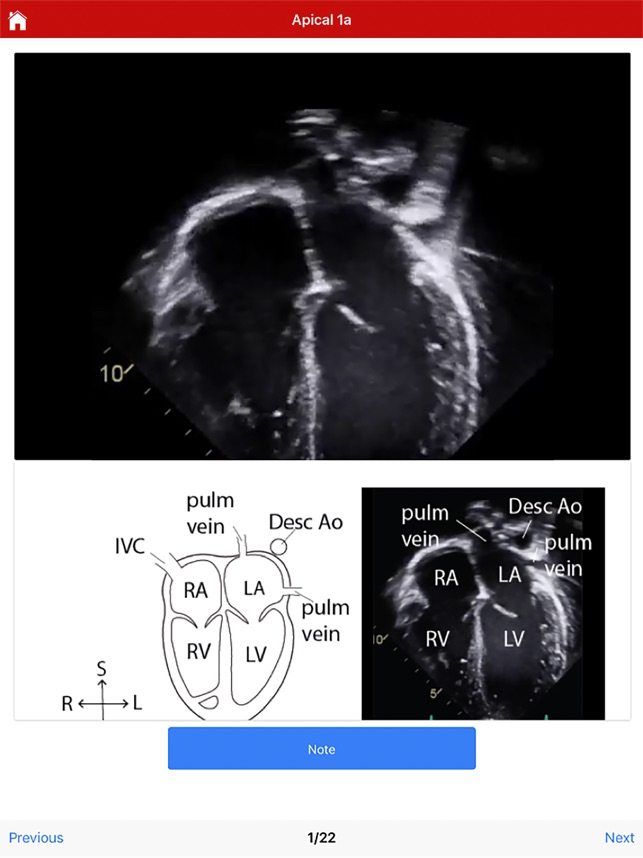 Echo UW screenshot 5 of 10