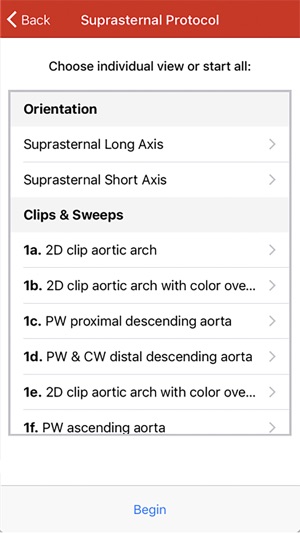 Echo UW screenshot 7 of 10