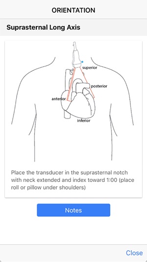 Echo UW screenshot 8 of 10