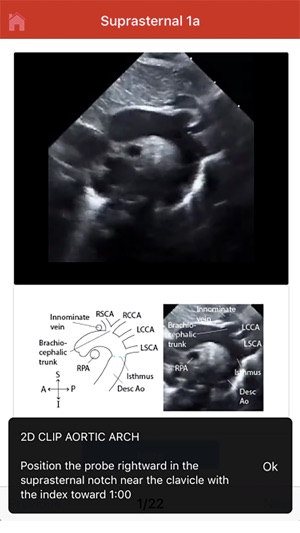 Echo UW screenshot 9 of 10