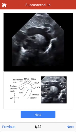 Echo UW screenshot 10 of 10