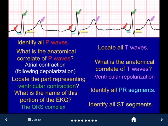 EKG - SecondLook screenshot 3 of 10
