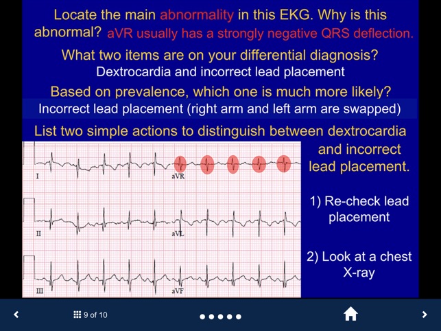 EKG - SecondLook screenshot 4 of 10