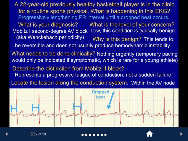 EKG - SecondLook screenshot 5 of 10