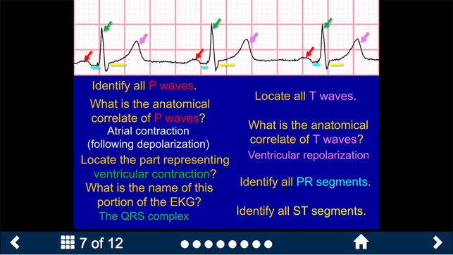 EKG - SecondLook screenshot 8 of 10