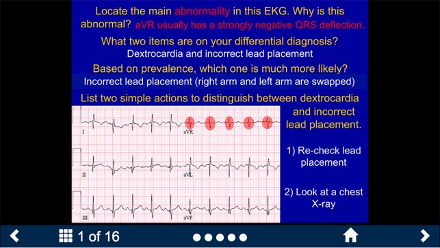 EKG - SecondLook screenshot 9 of 10