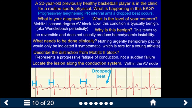EKG - SecondLook screenshot 10 of 10