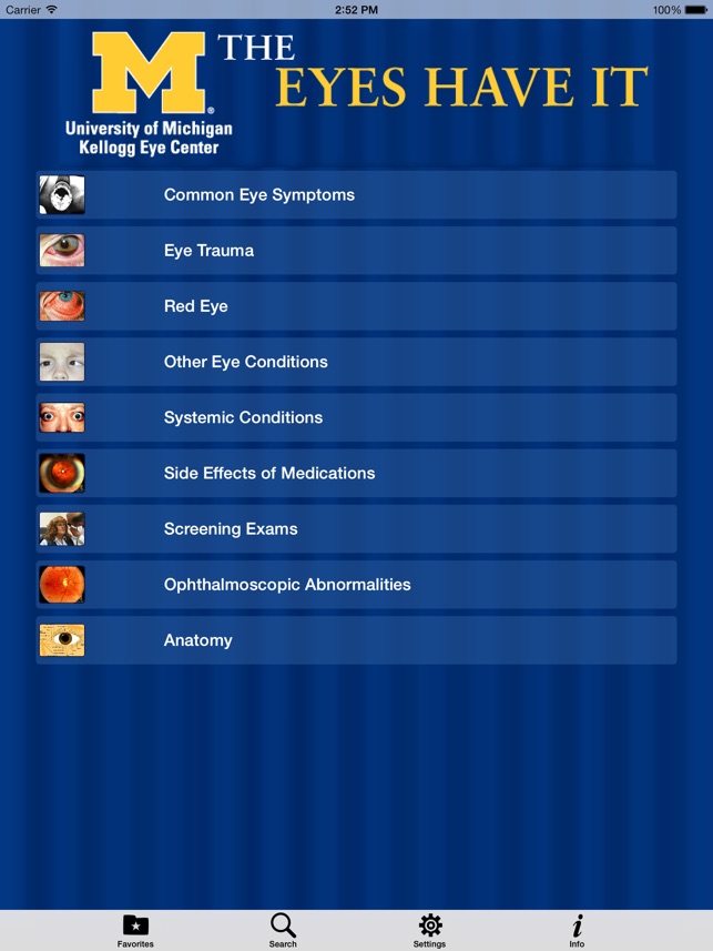 EyesHaveIt screenshot 1 of 10