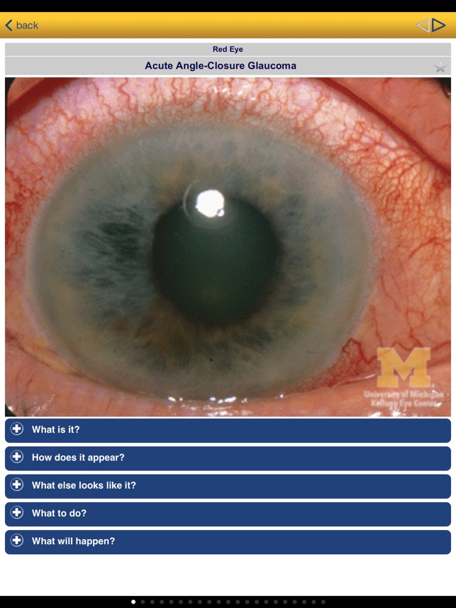 EyesHaveIt screenshot 3 of 10