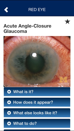 EyesHaveIt screenshot 9 of 10