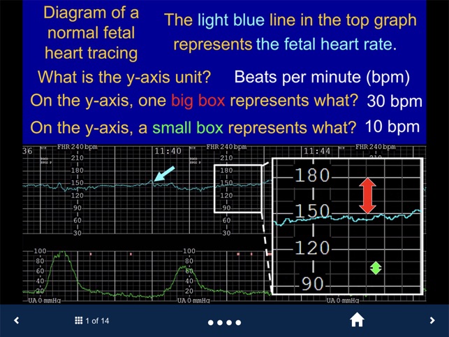 Fetal Heart Rate - SecondLook screenshot 2 of 15
