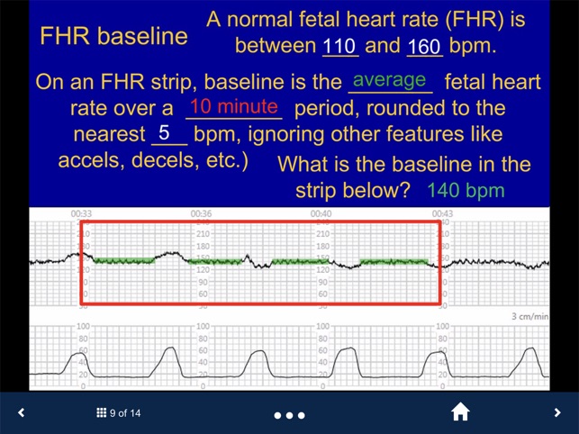 Fetal Heart Rate - SecondLook screenshot 3 of 15
