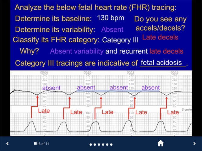 Fetal Heart Rate - SecondLook screenshot 5 of 15