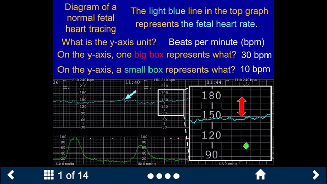 Fetal Heart Rate - SecondLook screenshot 7 of 15