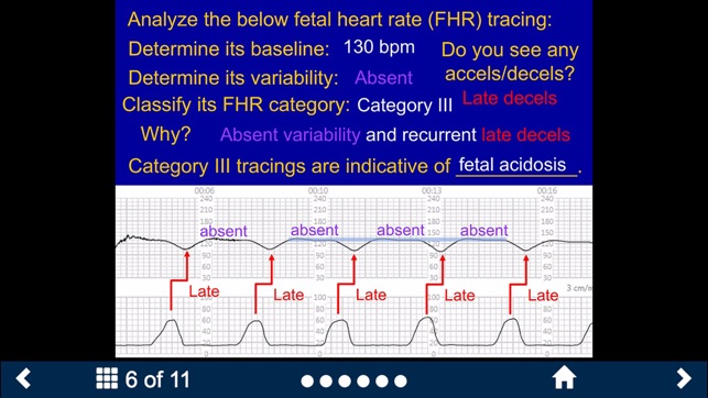 Fetal Heart Rate - SecondLook screenshot 10 of 15