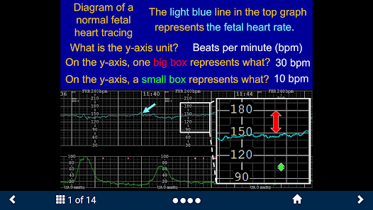 Fetal Heart Rate - SecondLook screenshot 12 of 15