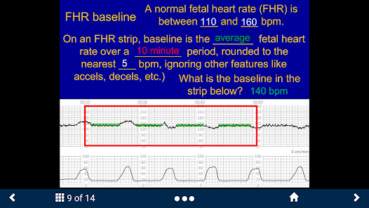Fetal Heart Rate - SecondLook screenshot 13 of 15